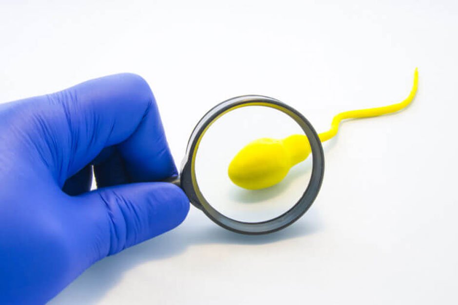 Vasectomy and Advanced Imaging for Sperm Flow Assessment