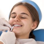 6 Questions to Ask Before Selecting an Orthodontist in Peabody