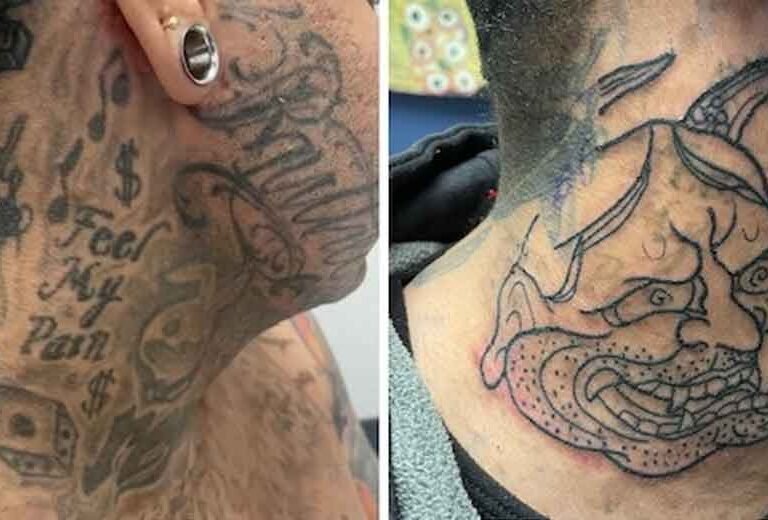 Choosing-Between-Tattoo-Removal,-Touch‑Ups,-or-Cover‑Ups-—-What-Works-When