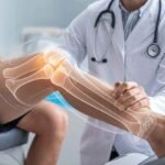 Early-Signs-You-Should-Seek-Professional-Care-for-a-Knee-Injury