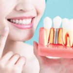 The Lifelong Benefits of Choosing Dental Implants for Tooth Restoration in Winnipeg