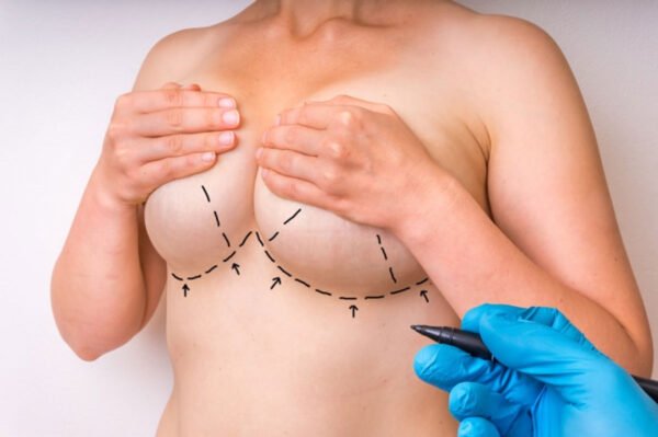 How Do Surgeons in Utah Evaluate Candidacy for a Breast Lift