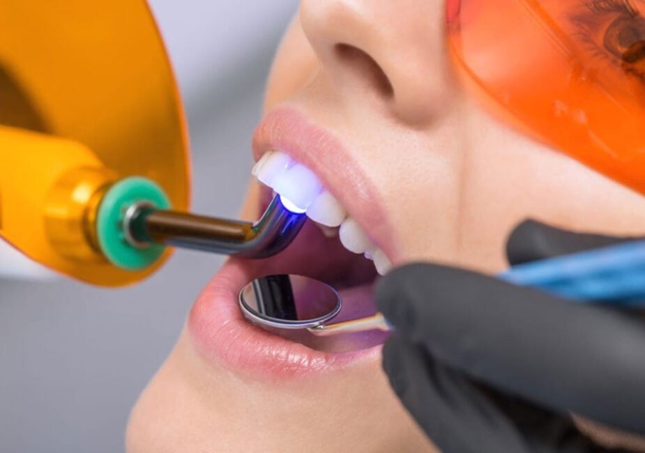 Types of Restorative Procedures Offered By A Dentist in Maple Ridge